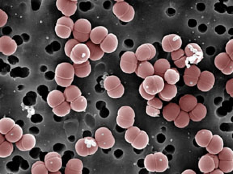 pediococcus damnosus beer